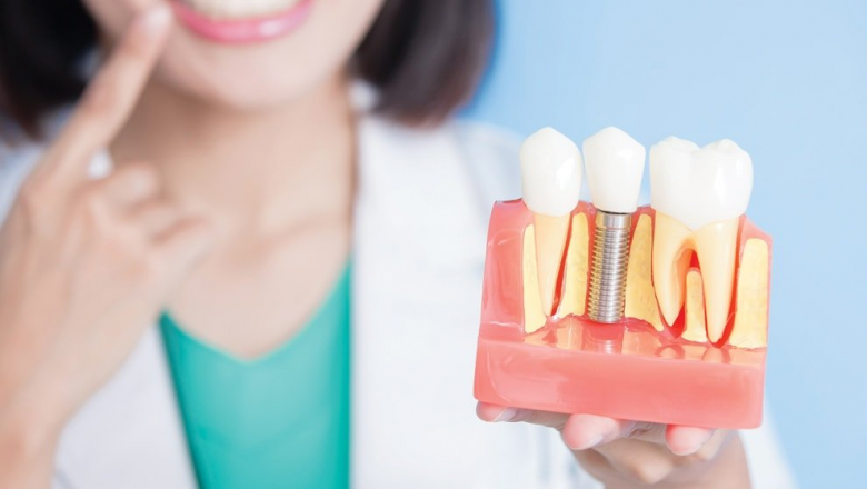 Factors to Consider for Choosing the Best Dental Implant Clinic