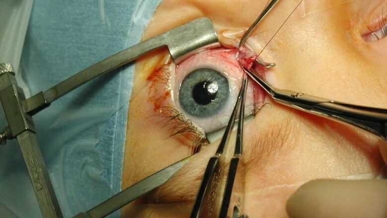 Eye Surgeries, For A Powerful And An Effective Vision