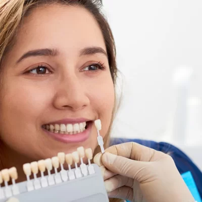 Why Should You Consider Dental Veneers?