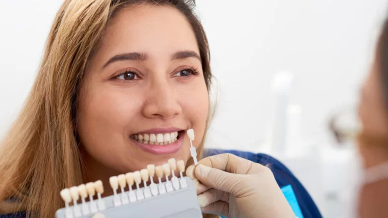 Why Should You Consider Dental Veneers?