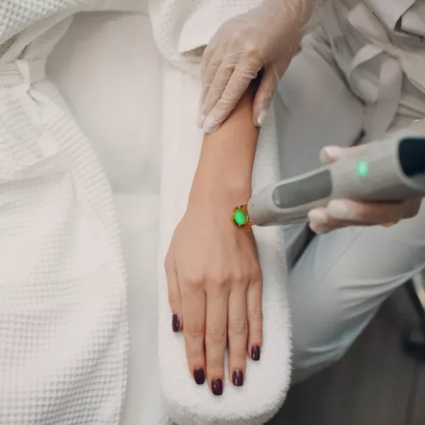 CO₂ Wart Removal, Laser Wart Removal, and General Wart Removal – A Simple Guide