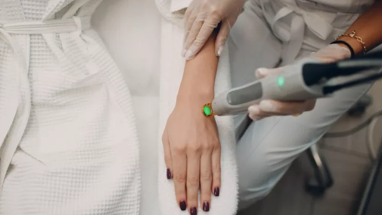 CO₂ Wart Removal, Laser Wart Removal, and General Wart Removal – A Simple Guide